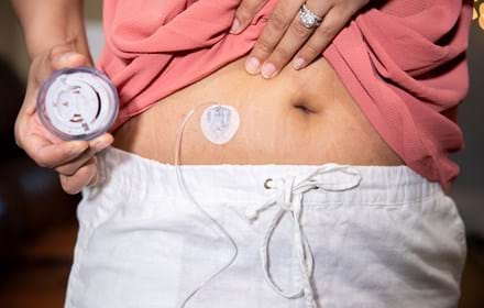 Woman Holds Insulin Pump In Her Hand